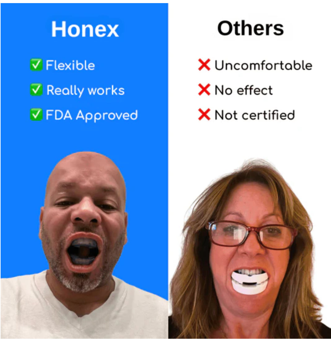 Anti-Snoring Mouthpiece