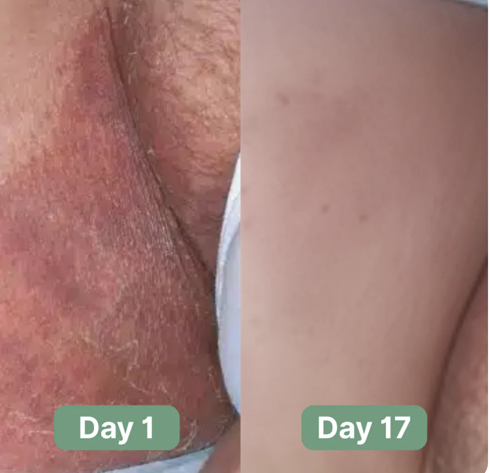 Tea Tree & Sulfur Cleansing Bar