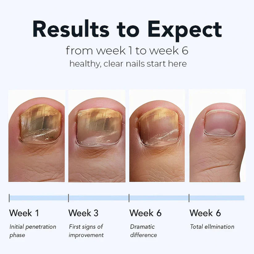 Nail Renewal Patches