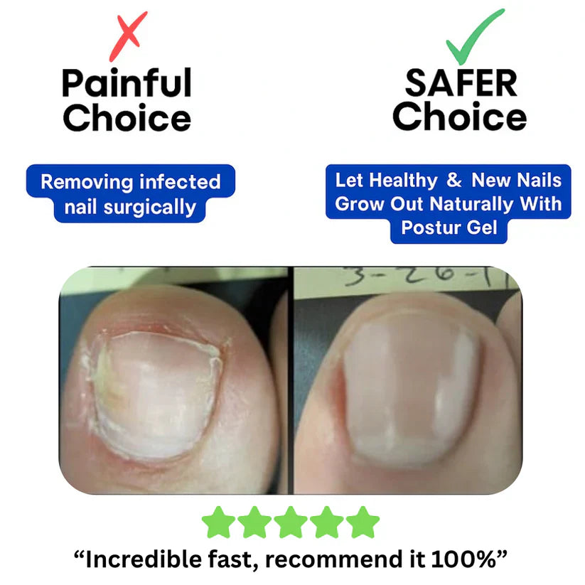 Nail Renewal Patches