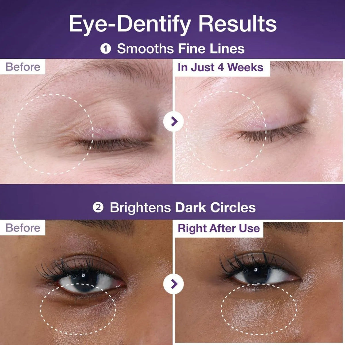 NAD+ Retinol Eye Cream in use