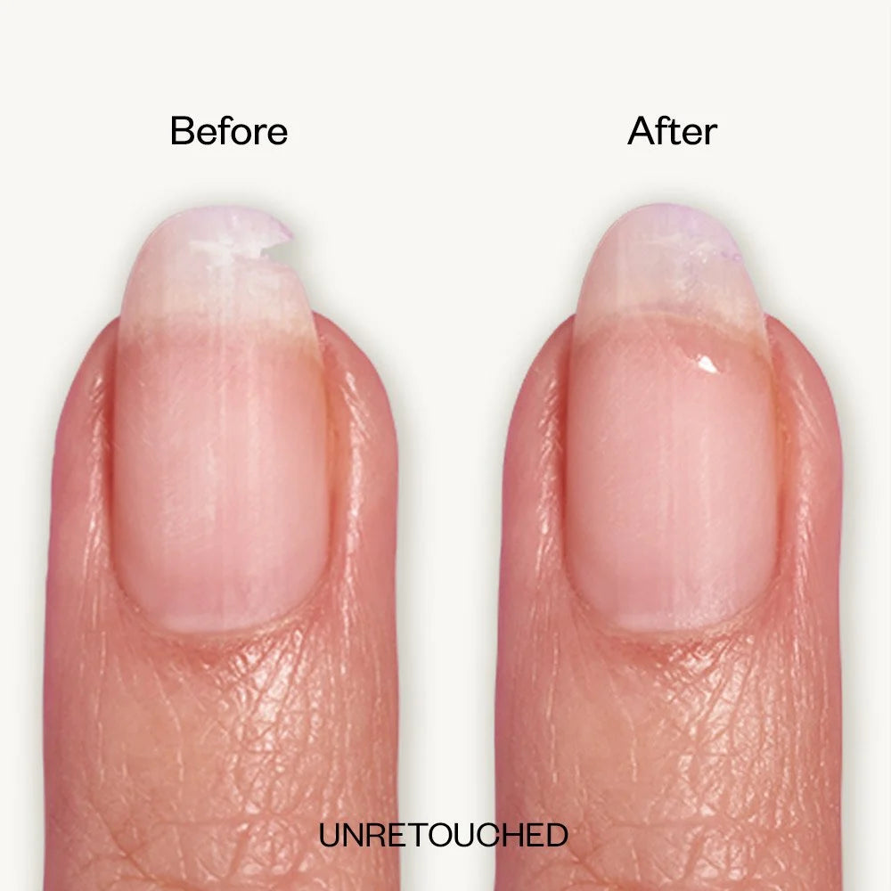 Clear Nail Repair Patch