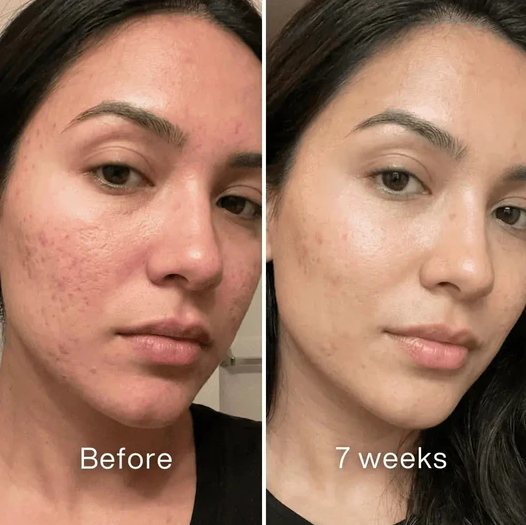Skin Recovery Serum No. 01