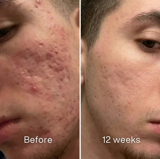 Skin Recovery Serum No. 01