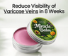 Varicose Vein Balm