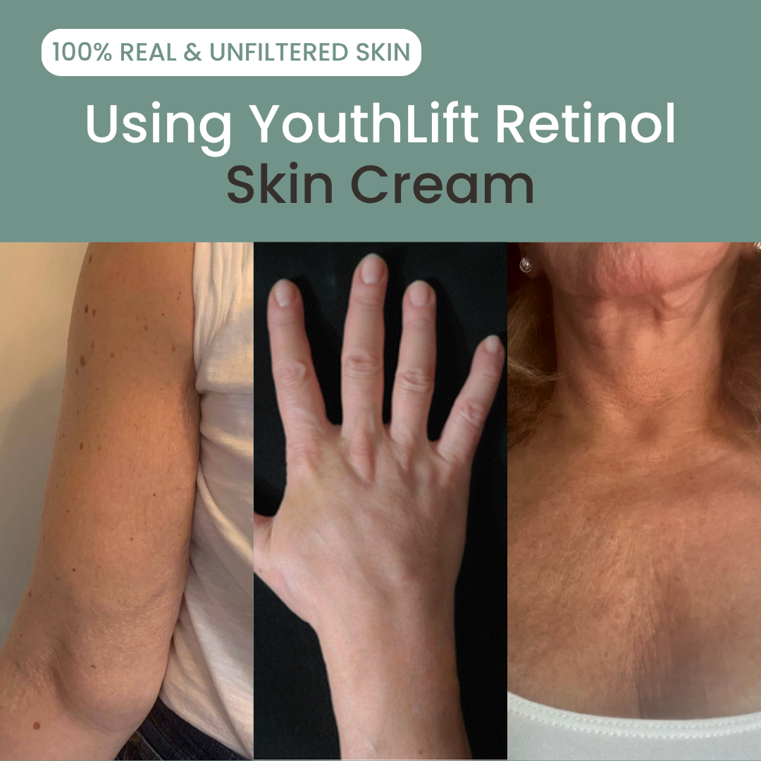 Retinol Renewal Hand & Neck Cream