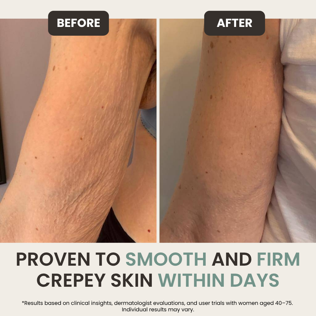 Retinol Renewal Hand & Neck Cream
